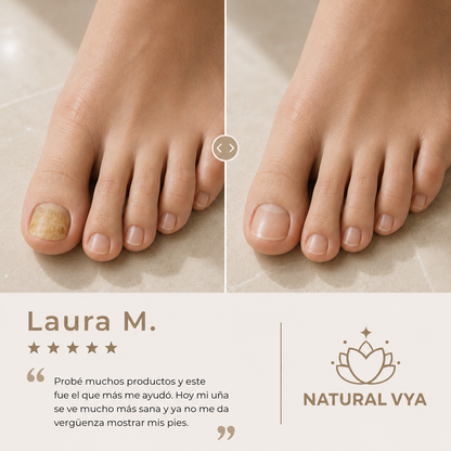 Aceite Para Combatir El Hongo De Las Uñas